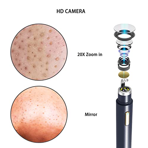 Muški vidljivi ekstraktor mitesera[2022 novo], napredni Pimple Popper sa 20x kamerom Acne Comedone Whitehead