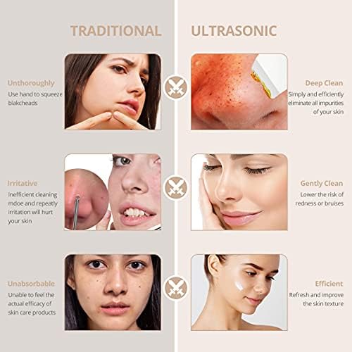 Skin Scrubber Spatula za lice - Hotsch sredstvo za uklanjanje mitesera,ultrazvučno sredstvo za čišćenje