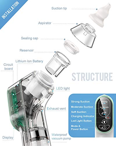 Nosni aspirator za baby dynabliss baby nos sisa sa 4 medicinske silikonske vrhove i 3 razine
