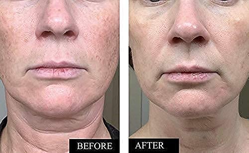 Set kreme za učvršćivanje lica i vrata vitamina C-prirodni Set za njegu kože protiv starenja za žene i muškarce za smanjenje bora, tamnih tačaka ,oštećenja od Sunca i opuštene kože uz poboljšanje elastičnosti kože