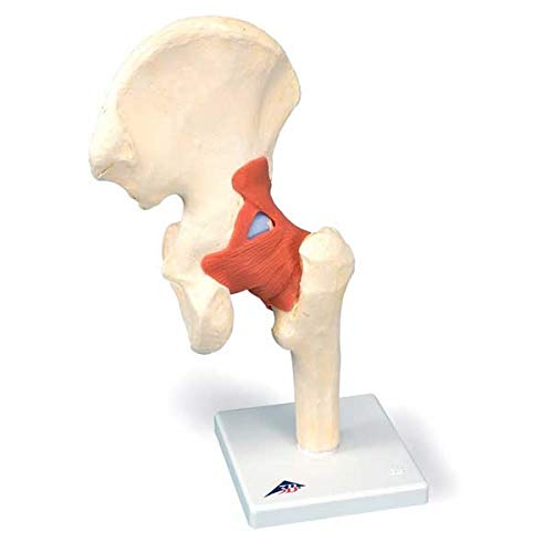 Hip potpuno funkcionalan kosti zajednički Model SSM