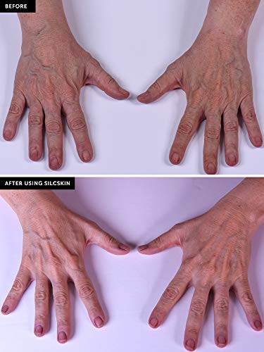 SilcSkin Hand & body Treatment - koristi medicinski silikon za poboljšani kolagen i hidrataciju - cilja Crepey kožu, Fine linije, bore na rukama, laktovima, kolenima, stomaku, bedrima & amp; Više - 4 oz